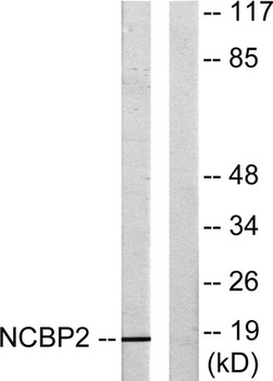 CBP20 rabbit pAb Antibody