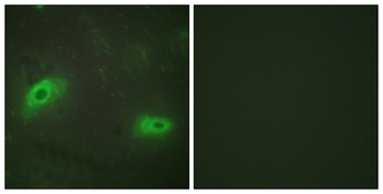 CD137L rabbit pAb Antibody