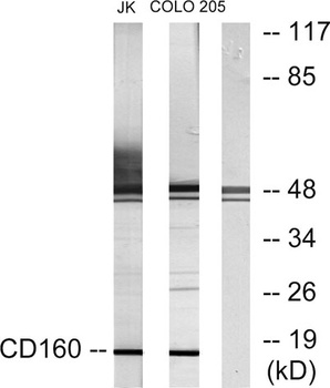 CD160 rabbit pAb Antibody