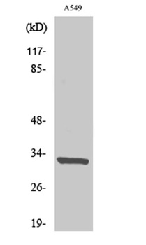 CD20 rabbit pAb Antibody