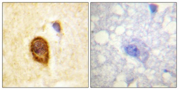 CD4 rabbit pAb Antibody