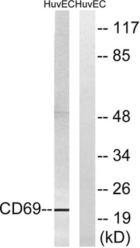 CD69 rabbit pAb Antibody
