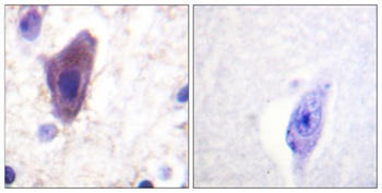 CD71/TfR rabbit pAb Antibody