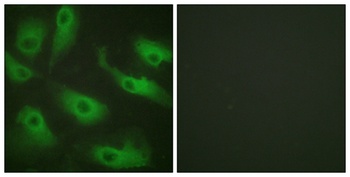 Cdc37 rabbit pAb Antibody