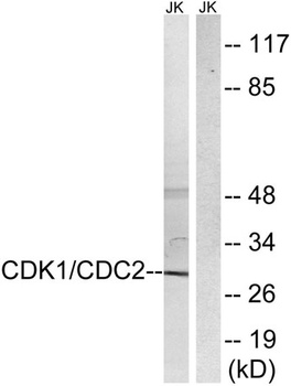 Cdk1/2/3 rabbit pAb Antibody