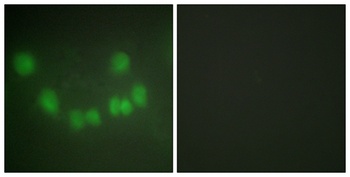 Cdk1/Cdc2 rabbit pAb Antibody