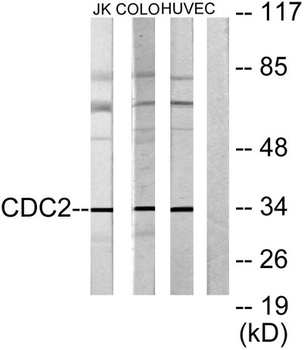 Cdk1/Cdc2 rabbit pAb Antibody