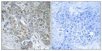 Cdk8 rabbit pAb Antibody