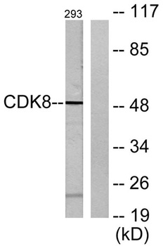 Cdk8 rabbit pAb Antibody