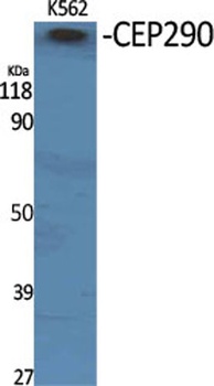 CEP290 rabbit pAb Antibody