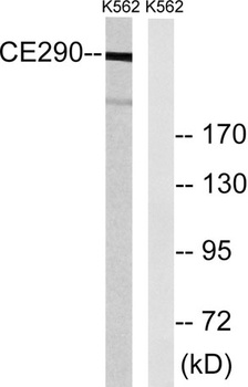 CEP290 rabbit pAb Antibody