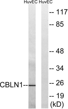 Cerebellin 1 rabbit pAb Antibody