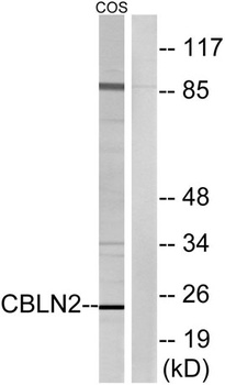 Cerebellin 2 rabbit pAb Antibody