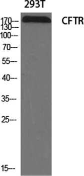 CFTR rabbit pAb Antibody
