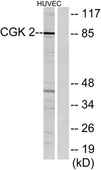 cGKII rabbit pAb Antibody