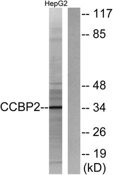 Chemokine Receptor D6 rabbit pAb Antibody