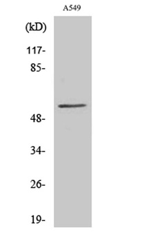 CHST2 rabbit pAb Antibody
