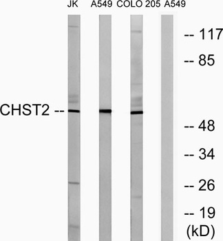 CHST2 rabbit pAb Antibody