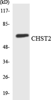 CHST2 rabbit pAb Antibody