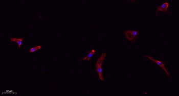 Claudin-1 rabbit pAb Antibody