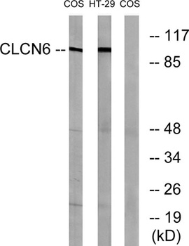 CLC-6 rabbit pAb Antibody