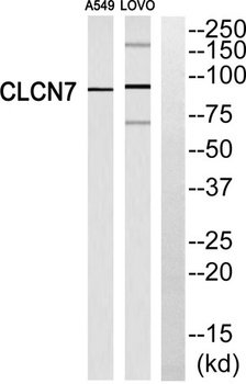 CLC-7 rabbit pAb Antibody
