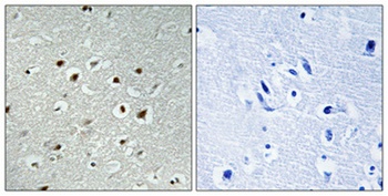 CLK2 rabbit pAb Antibody