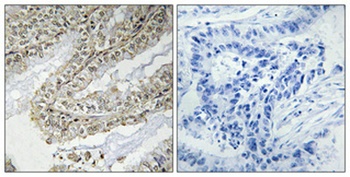 Cofilin rabbit pAb Antibody