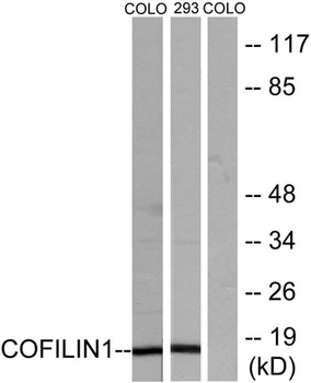 Cofilin rabbit pAb Antibody