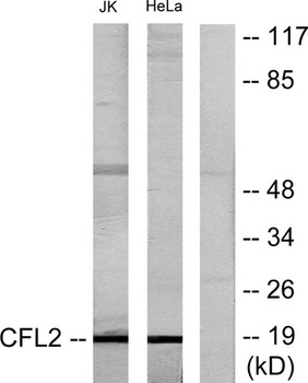 Cofilin rabbit pAb Antibody
