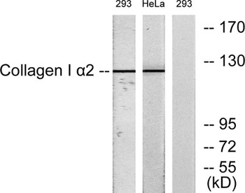 COL1A2 rabbit pAb