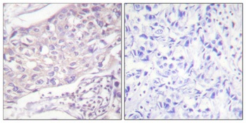 COT rabbit pAb Antibody