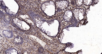 CRABP-II rabbit pAb Antibody