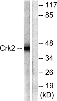 Crk II rabbit pAb Antibody