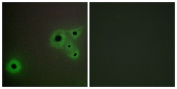CRSP130 rabbit pAb Antibody