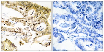 CRSP130 rabbit pAb Antibody