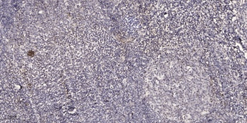 CRSP77 rabbit pAb Antibody