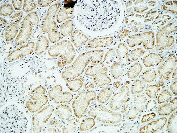 Crystallin-αB rabbit pAb Antibody