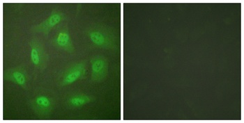 CSN3 rabbit pAb Antibody