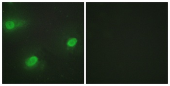 CstF-64 rabbit pAb Antibody