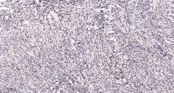 CstF-64 rabbit pAb Antibody