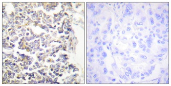 C-TAK1 rabbit pAb Antibody