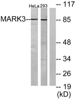 C-TAK1 rabbit pAb Antibody