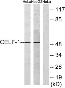 CUG-BP1 rabbit pAb Antibody