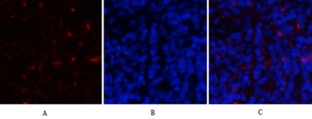 Cyclin D1 rabbit pAb Antibody