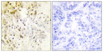 Cyclin L1 rabbit pAb Antibody