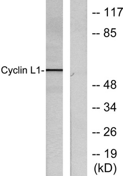 Cyclin L1 rabbit pAb Antibody
