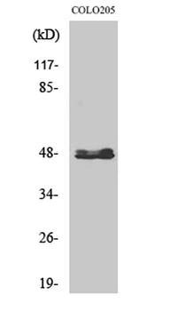 CYP11B1/2 rabbit pAb Antibody