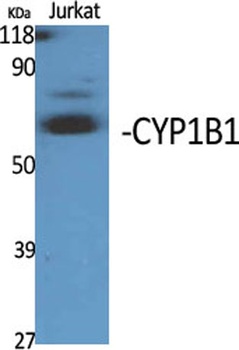 CYP1B1 rabbit pAb Antibody
