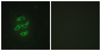 CYP2J2 rabbit pAb Antibody